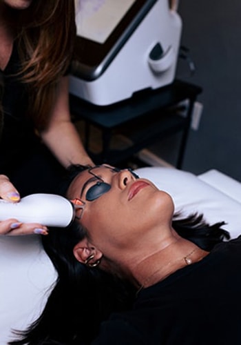 Client Receiving Laser Facial Resurfacing