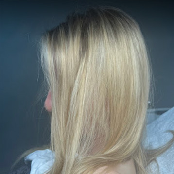 image of Anna's Hair